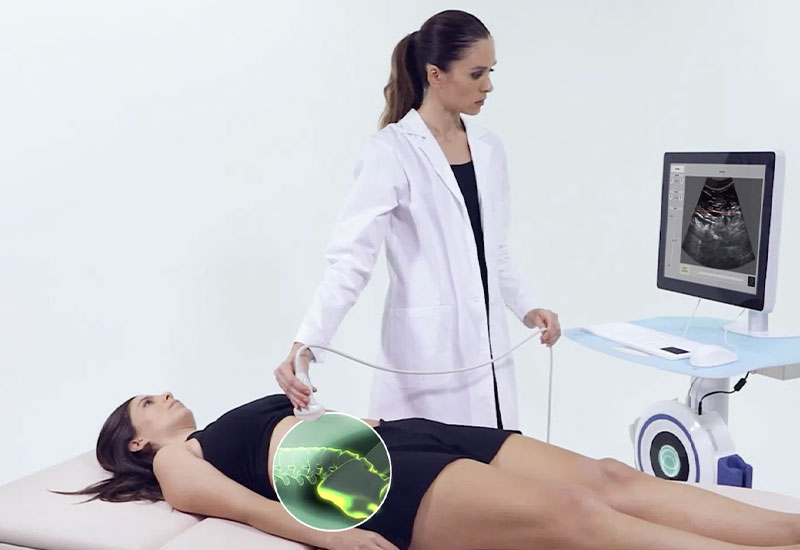 Echolight Bakersfield